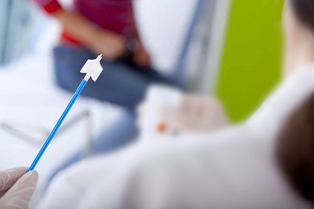 ग्रीवा क्यान्सर स्क्रीनिंगमा प्रगतिहरू: स्व-संग्रह HPV परीक्षणको भूमिका