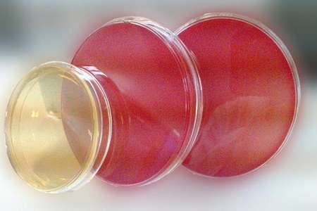 साल्मोनेला Shigella Ager (SS): रोगजनक एक्लोपनाको लागि आवश्यक माध्यधिएको मध्यम