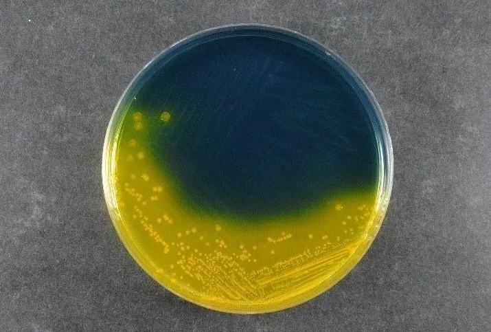 खाद्य सुरक्षा सुनिश्चित गर्दै: बबीियोको साल्निओले सल्मोलाला Shigella Agera (ss) ग्लोबल Parsogen पत्ता लगाउन को समर्थन गर्दछ