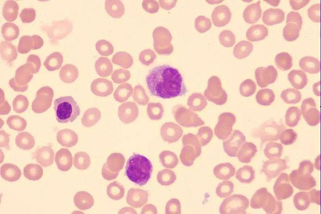 बाबियोले ग्लोबल प्रयोगशालाहरूको लागि उच्च-गुणवत्ताको जिस्का घिनलाग्दो समाधान सुरू गर्यो