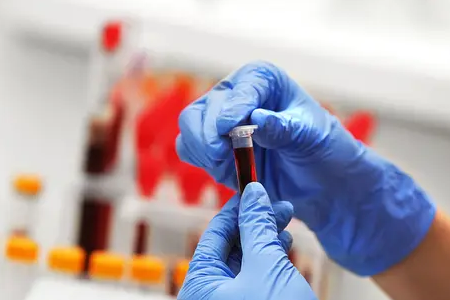 BABIO ले फ्लोरोसेन्स बोभिन प्रेग्नेंसी र्‍यापिड टेस्ट सुरु गर्‍यो