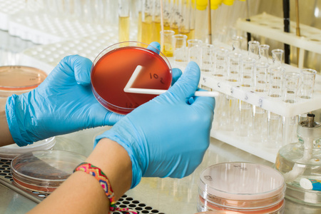 BABIO's MacConkey Agar मध्यम - ग्लोबल माइक्रोबायोलोजिकल डायग्नोस्टिक्सको लागि प्रीमियम चयनात्मक अलगाव